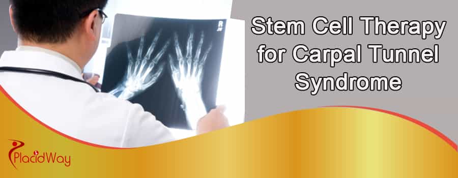 Stem Cell Therapy for Carpal Tunnel Syndrome Abroad